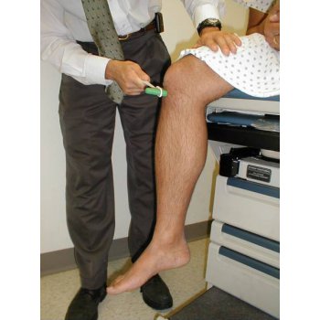 зачем невролог бьет молоточком по коленке. 125026979 neuro patellar. зачем невролог бьет молоточком по коленке фото. зачем невролог бьет молоточком по коленке-125026979 neuro patellar. картинка зачем невролог бьет молоточком по коленке. картинка 125026979 neuro patellar.