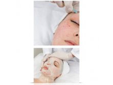 4058 Стерильная маска REVITAL ACTIVE MASK, саше
