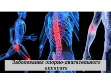 Заболевания опорно-двигательного аппарата