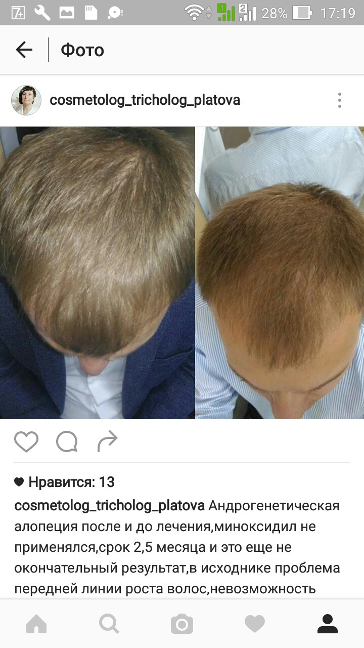 Screenshot 2016-09-23-17-19-26.jpg