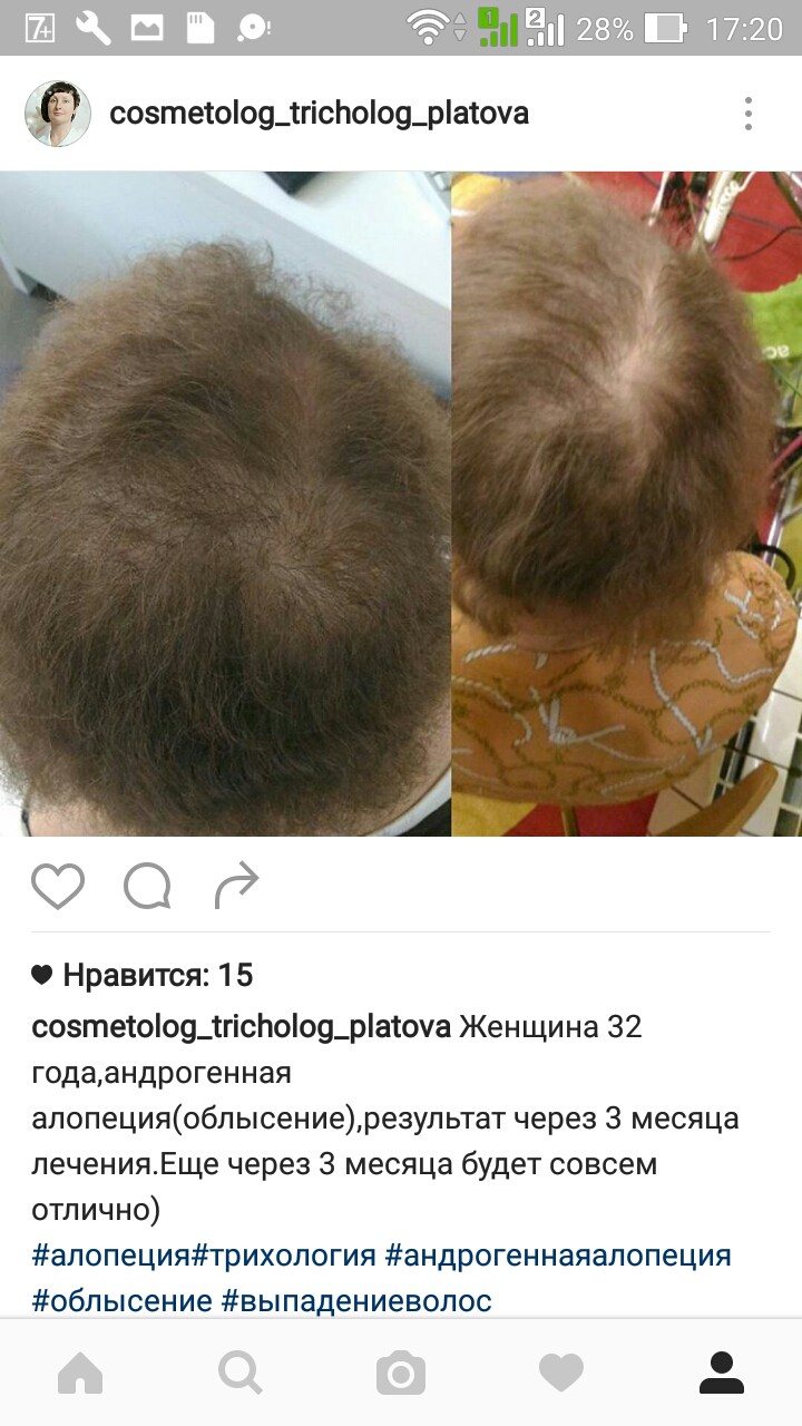Screenshot 2016-09-23-17-20-02.jpg