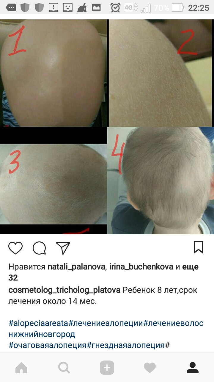 Screenshot 20180420-222510.jpg