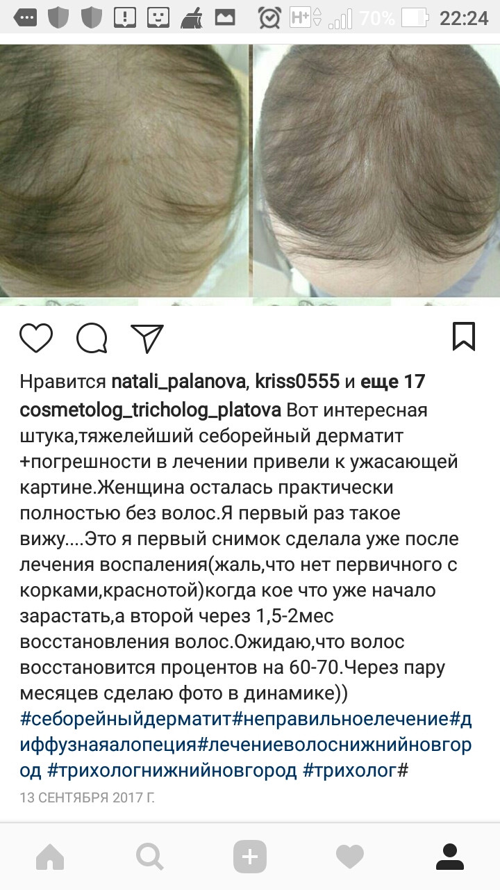 Screenshot 20180420-222406.jpg