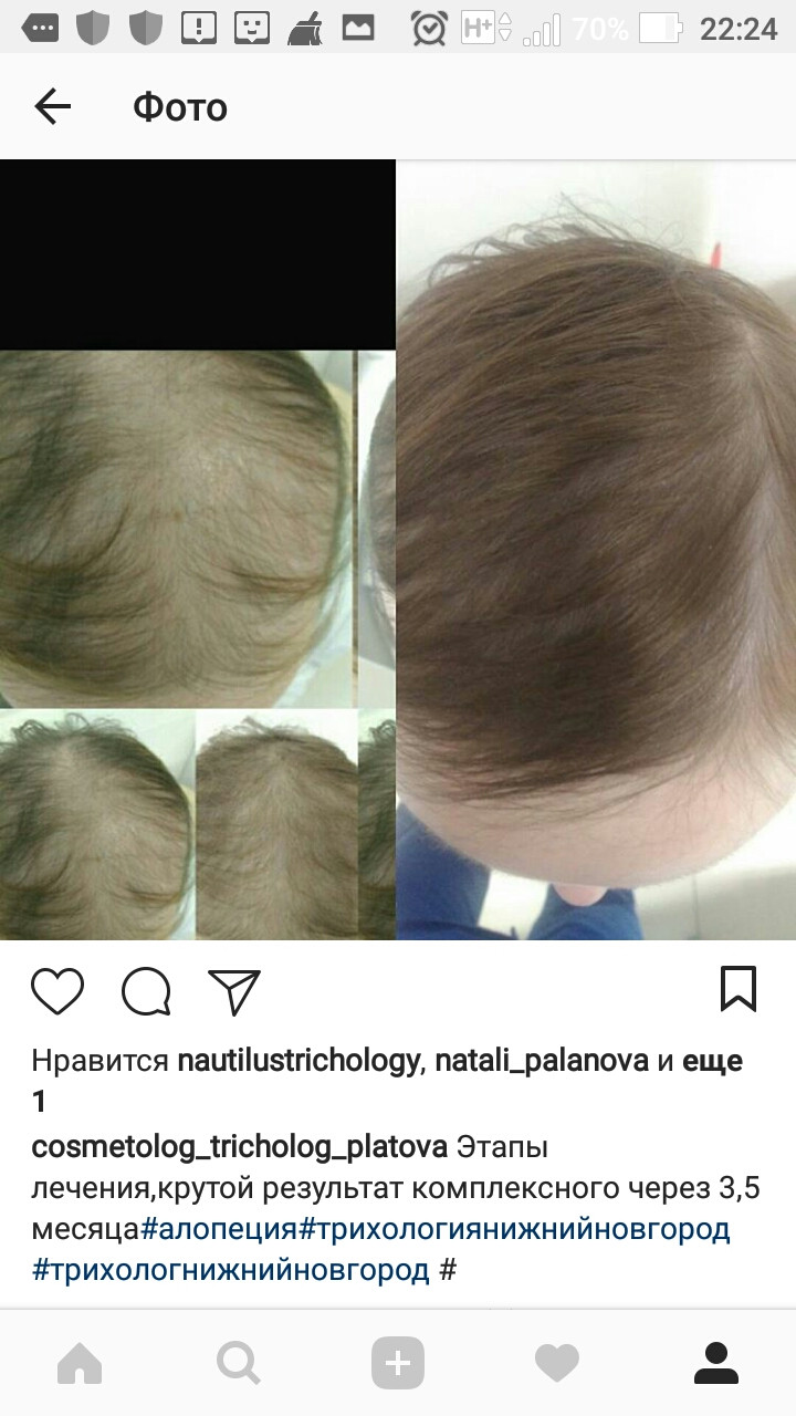 Screenshot 20180420-222417.jpg