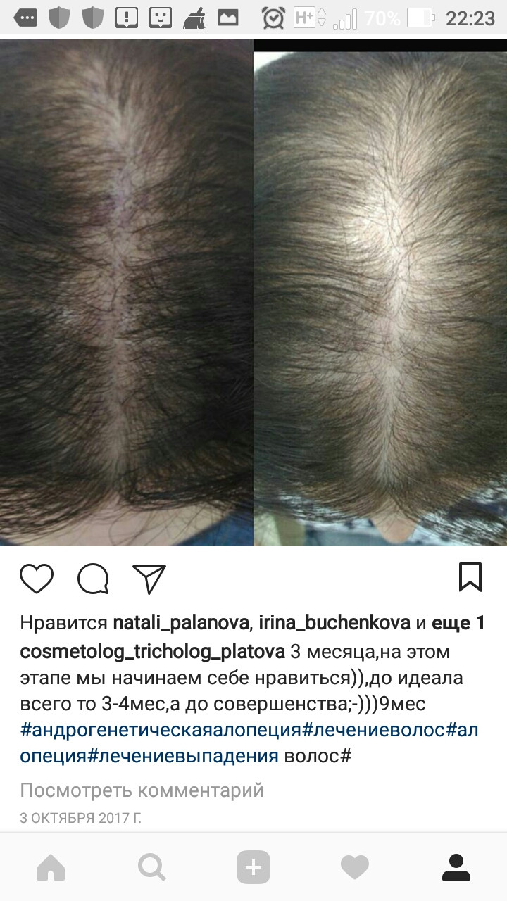 Screenshot 20180420-222332.jpg