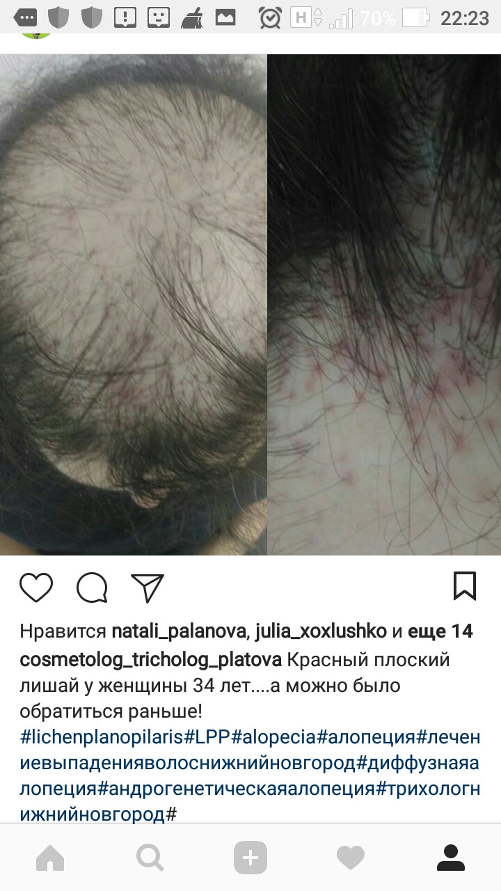 Screenshot 20180420-222342.jpg