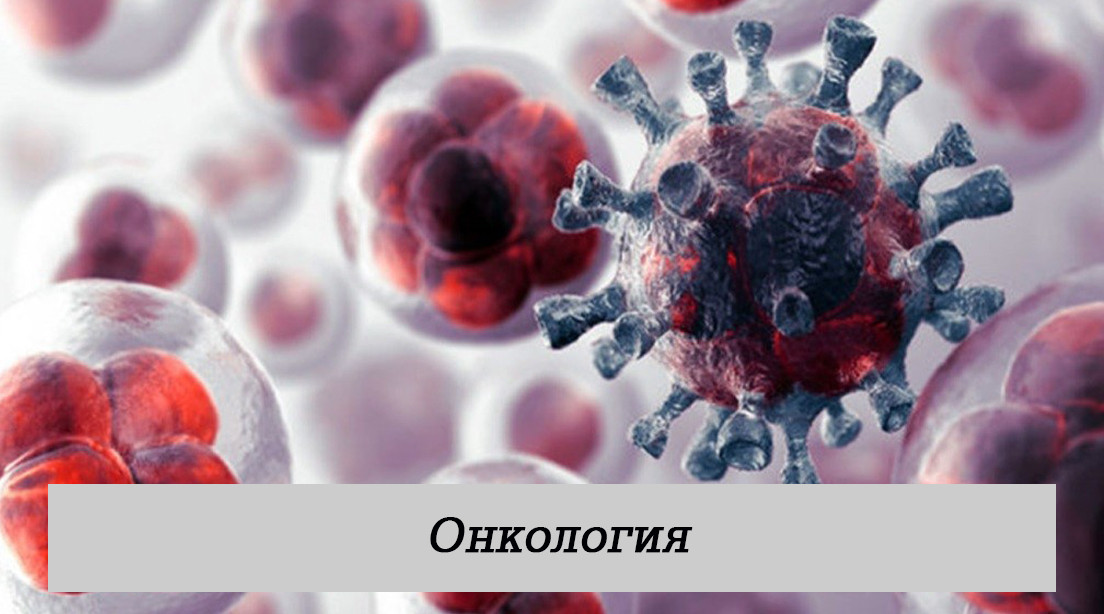Онкология
