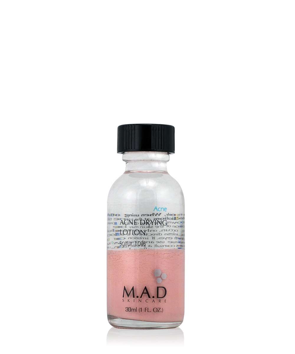 Acne Drying Lotion w Sulfur 10%-    10% 