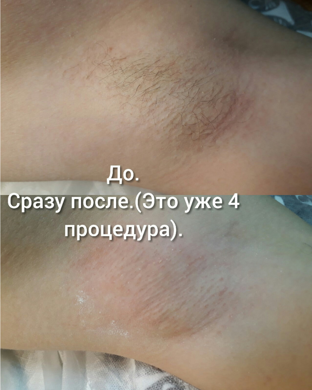 PfEDX2xz-bg.jpg